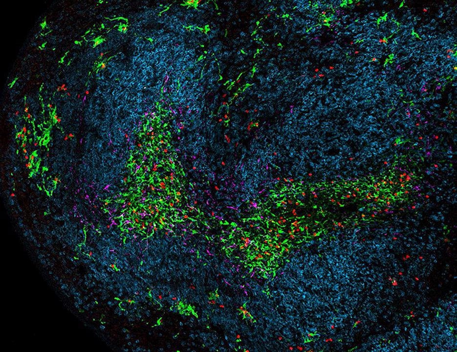 Checkpoint immunotherapy acts interface between killer T cells and dendritic cells