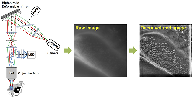 Research sheds light on non-invasive conjunctival goblet cell testing in patients