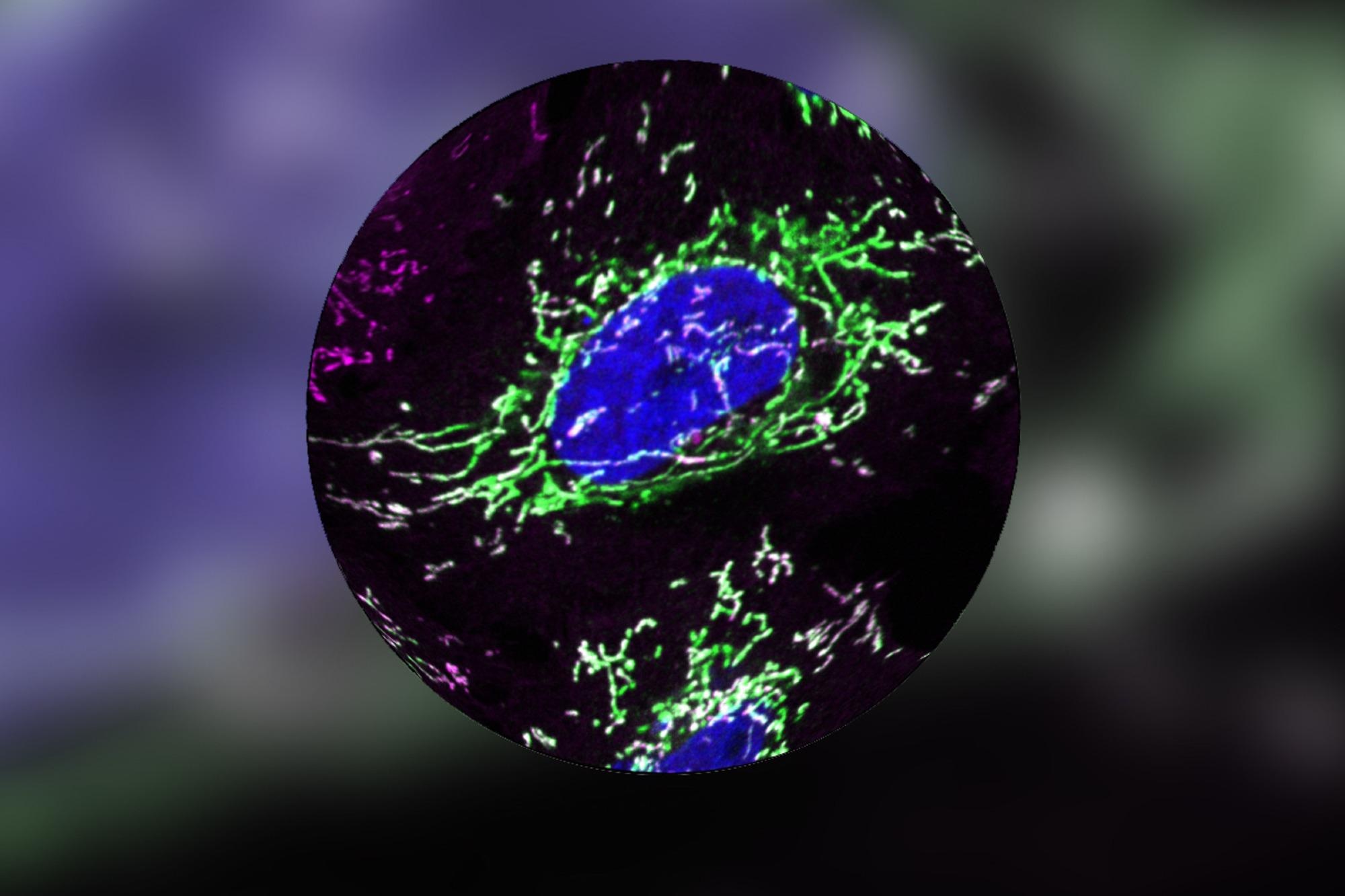 Researchers discover a mechanism by which the protein DELE1 detects organelle stress