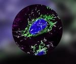 Researchers discover a mechanism by which the protein DELE1 detects organelle stress