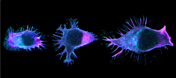 Immune cell migration contributes to inefficient antitumor immunity, study finds