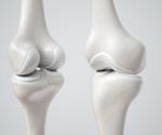 Researchers introduce injectable stem cell assembly, likely to serve as the treatment for cartilage regeneration