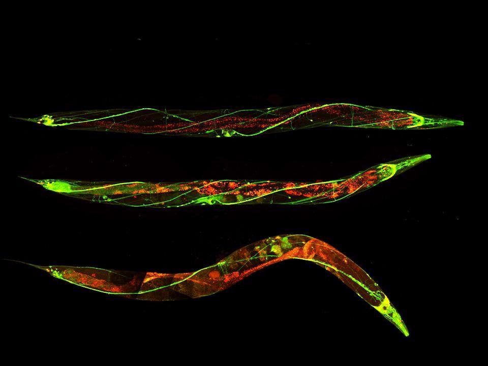 Research associates autophagy and age-related nervous system degradation