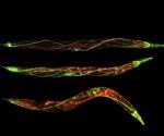 Research associates autophagy and age-related nervous system degradation