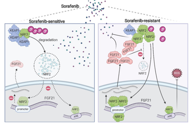 Study identifies novel targets for treating sorafenib-resistant hepatocellular carcinoma