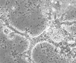 Scientists identify a new soil amoeba species in Chernevaya taiga