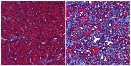 Researchers discover a protein that protects the pancreas from self-digestion