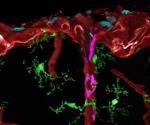 Researchers shed light on development and treatment of brain diseases