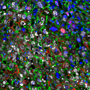 Study enhance how liver regeneration may help treat liver disease in mice
