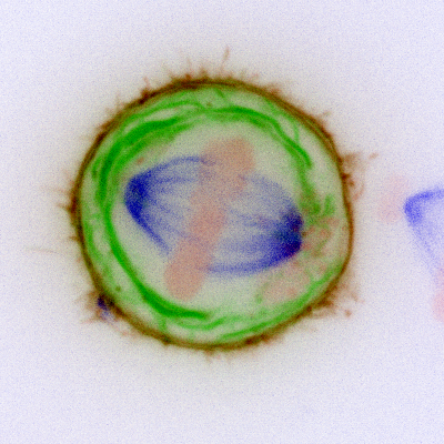 Study shows how key cause of cancer growth in cell formation may lead to prevention