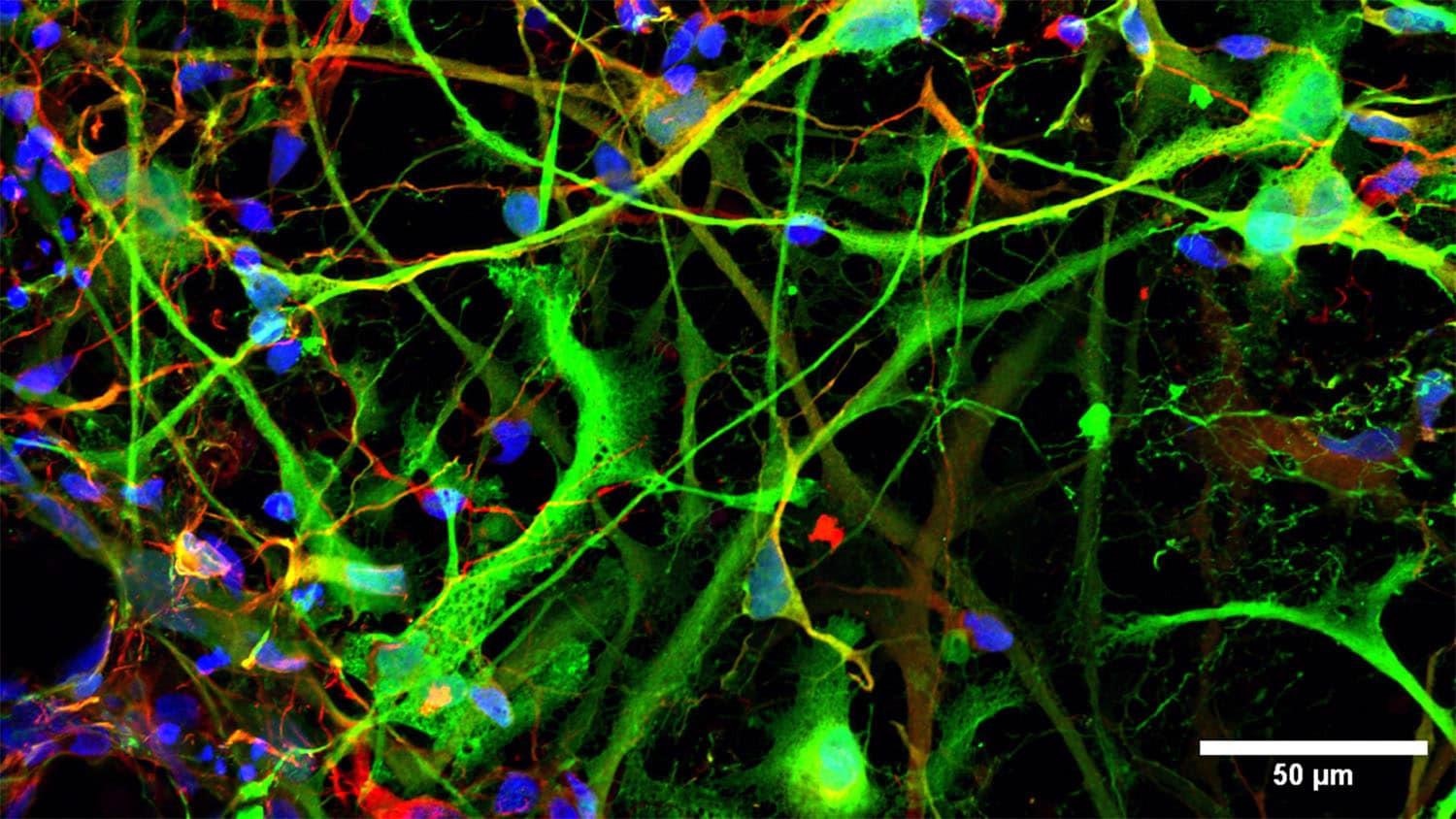 Researchers analyze the effect of dopamine on gene activity and addiction