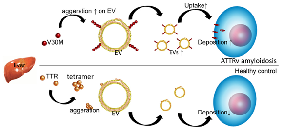 Study shows serum-derived extracellular vesicles may help to diagnose amyloidosis