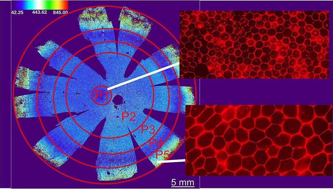 New retinal research promotes accurate treatments for blinding illness