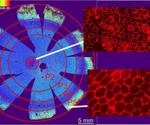 New retinal research promotes accurate treatments for blinding illness