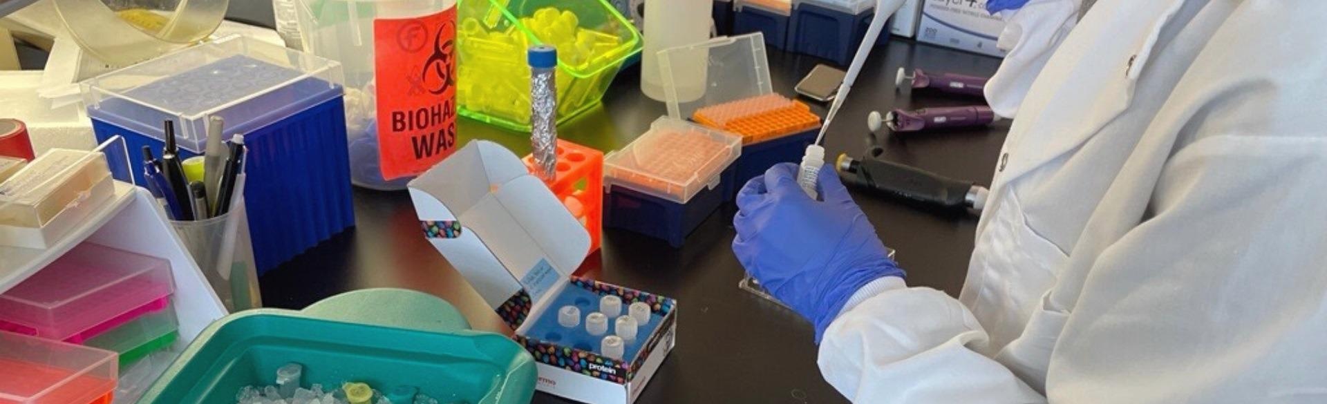 Scientist reveals the impact of mitochondria in metastatic prostate cancer
