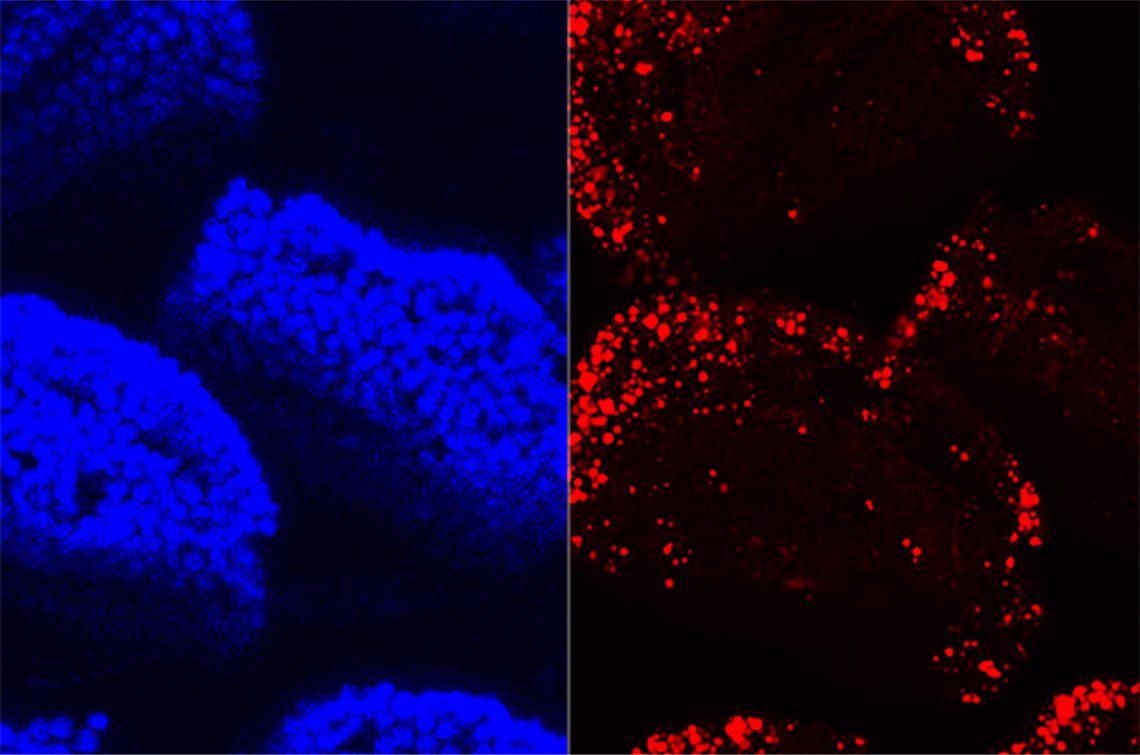 Research highlights how microbe-free mice absorb fat using different sets of genes