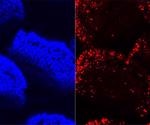 Research highlights how microbe-free mice absorb fat using different sets of genes