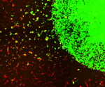 Researchers devise a new treatment approach to cure aggressive brain tumors