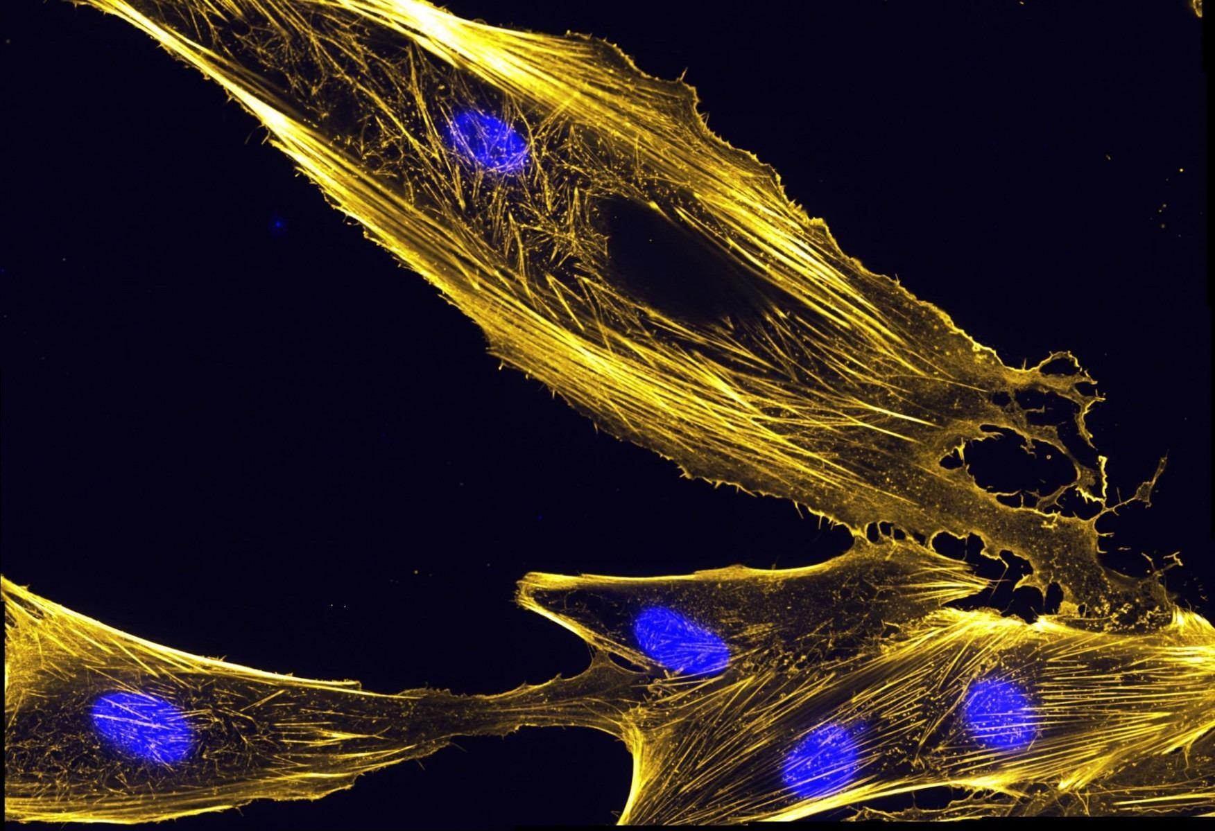 New study explores how human plastins behave in cells