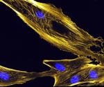 New study explores how human plastins behave in cells