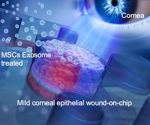 Researchers create human cornea-on-a-chip to check the therapeutic effect of MSC exosomes on corneal disorders