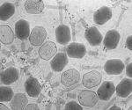 Study describes the importance of the autoimmune response in bacteria
