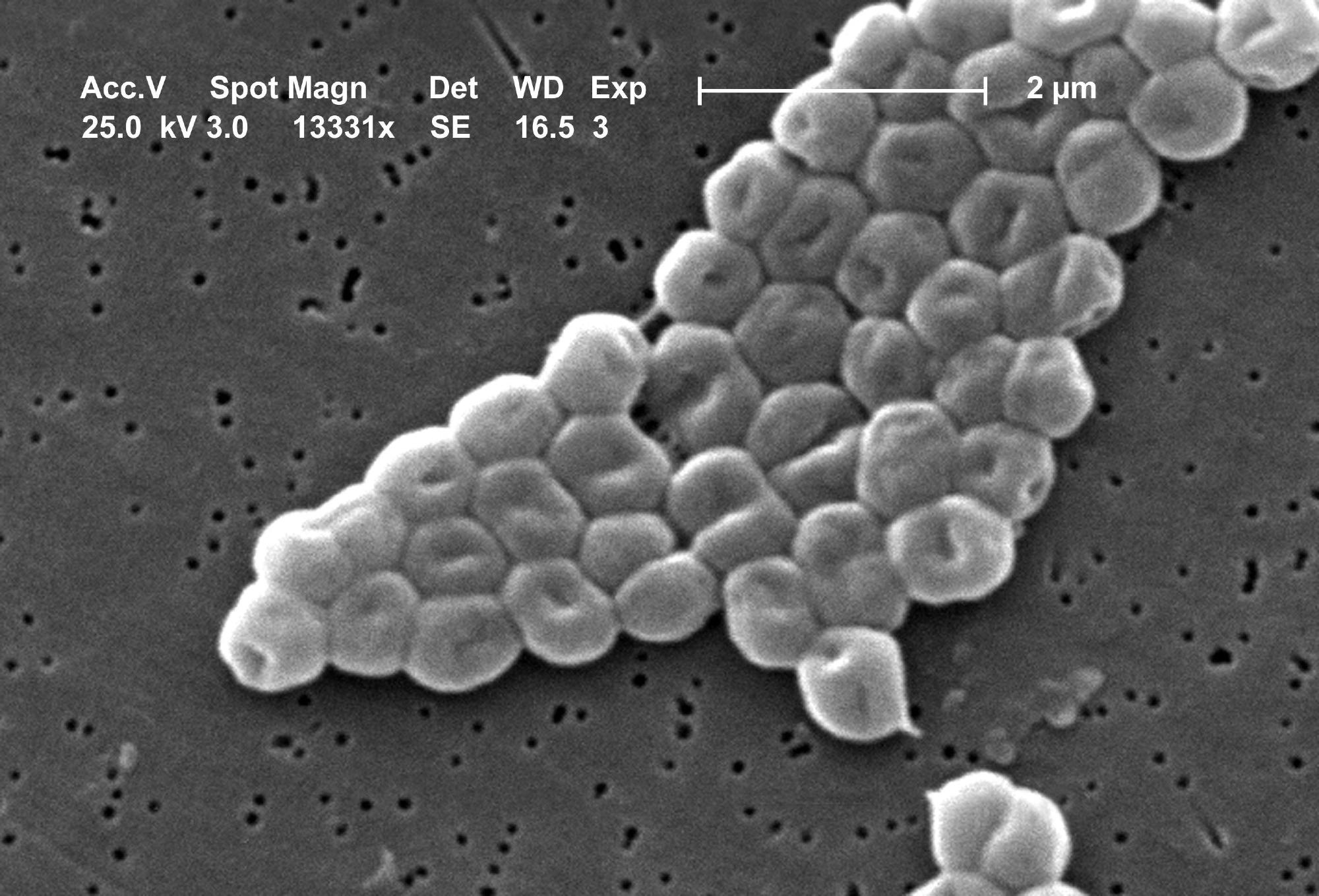 Research findings provide clues on the properties that might have made A. baumannii a successful pathogen