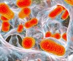 Research findings provide clues on the properties that might have made A. baumannii a successful pathogen
