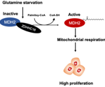 ZDHHC18-mediated MDH2 palmitoylation upholds mitochondrial respiration and boosts ovarian cancer malignancy