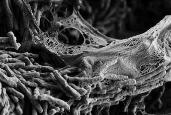 Genetic mutations allow great development of TB-causing bacteria