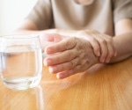 Research shows how new drugs may target genetic variations to slow Parkinson’s diseases