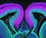 Research identifies the main gene that causes developmental disability syndrome