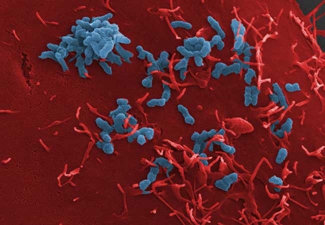 Study deciphers the mechanisms of bacterial host cell adhesion
