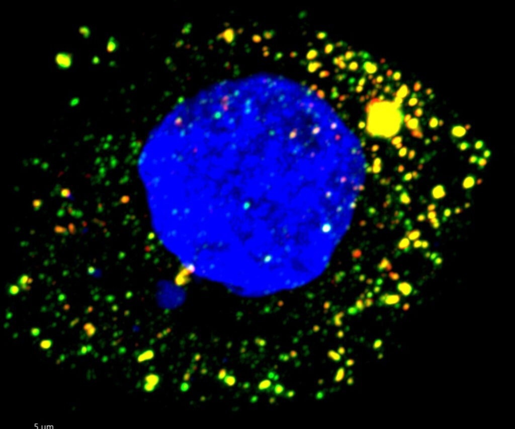 Study shows how drugs help to treat hepatitis A virus replication using an animal model