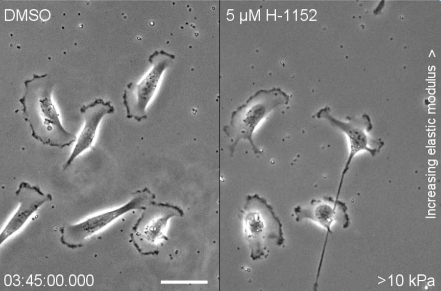 Researchers discover cancer cells move to sweet spot conditions, likely to enable stronger traction