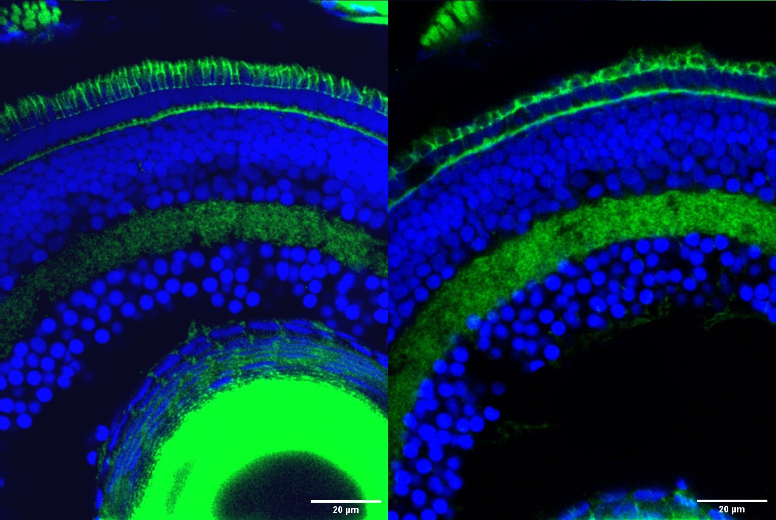 Researchers discover the gene essential for the growth of photoreceptors