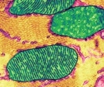 Researchers identify the molecular route that leads to autoimmune disease inflammation