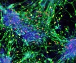 Research outlines how stem cells become sensory interneurons