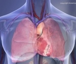 COVID-19 spike protein caused severe heart damage, new research shows