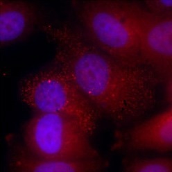Scientists solve how RNA molecules reach their targets