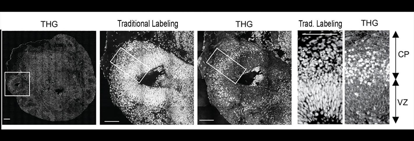 Scientists develop microscopy technology that observe the new neurons struggle to reach their developmental destination