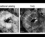 Scientists develop microscopy technology that observes how new neurons struggle to reach their developmental destination