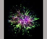 Researchers identify key molecular differences between initial and metastatic tumors