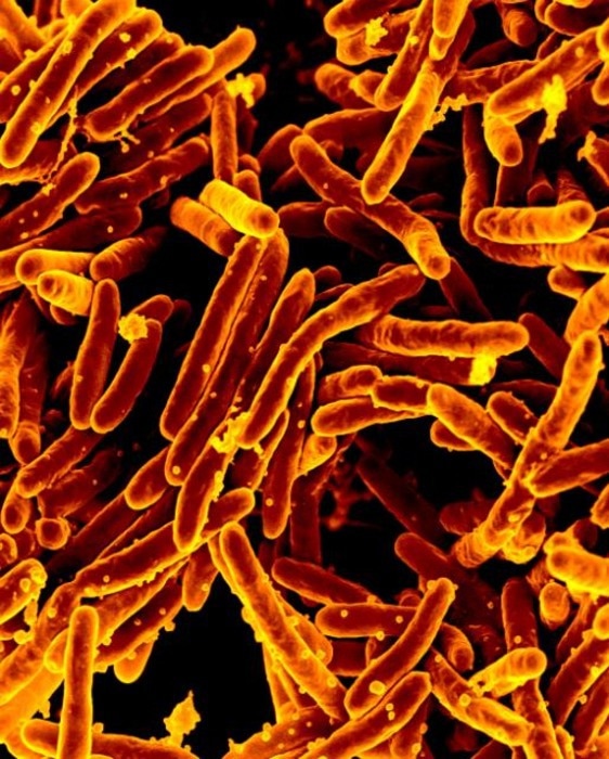 Researchers discover antibiotic resistance genes in M. tuberculosis