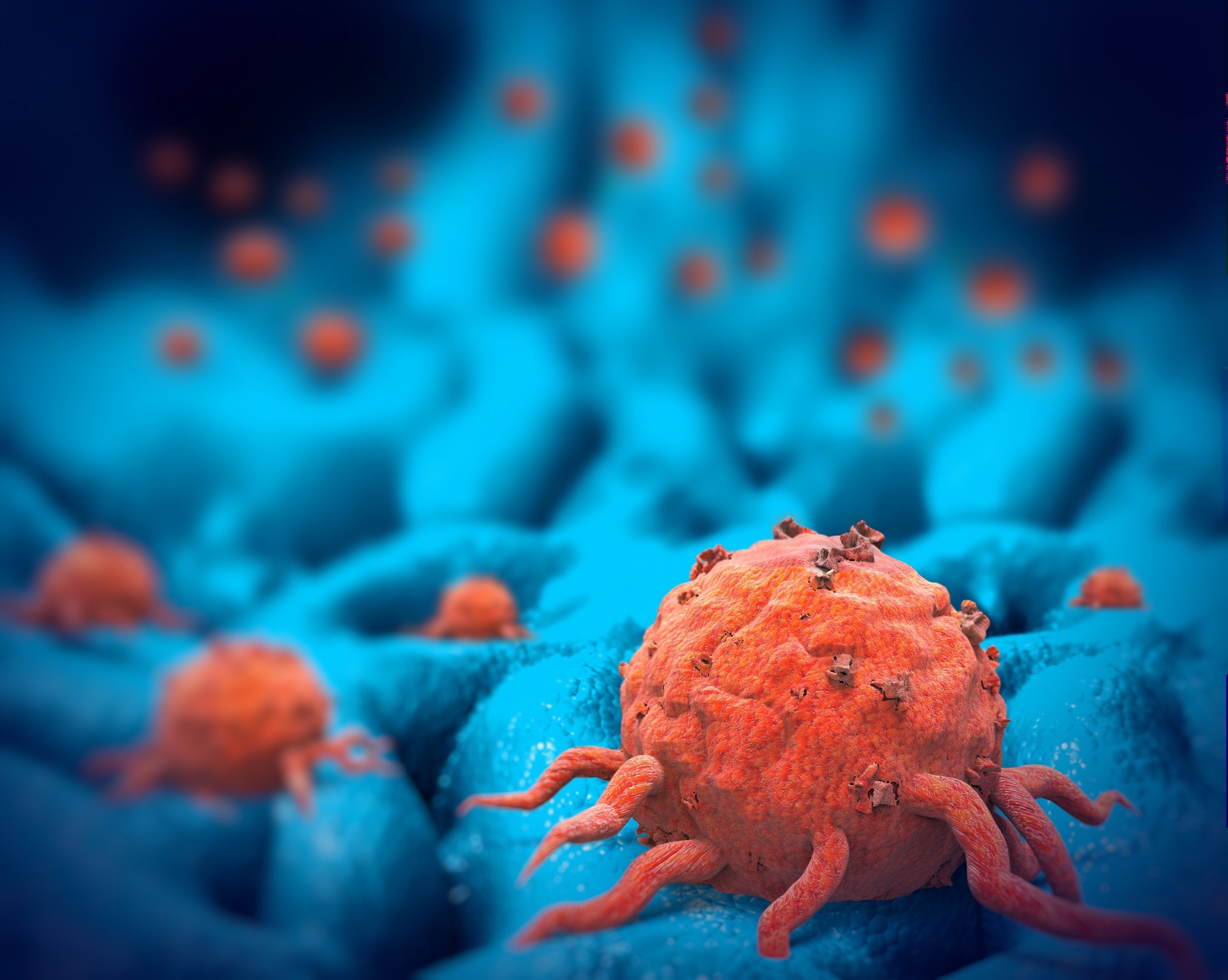 Tumor