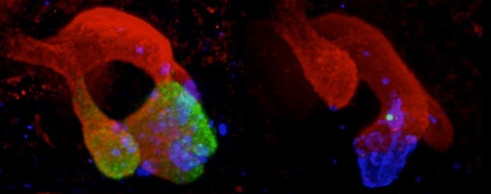 The complex link between pancreatic malformations and the “dark genome”