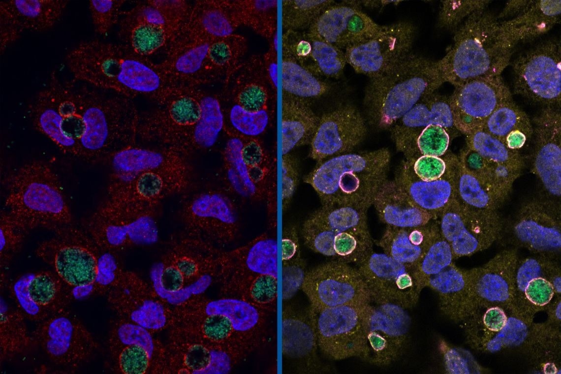 Researchers propose a way to identify Chlamydia, a deadly bacterial disease