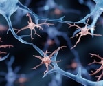 Characterizing the transcription profile of microglia in a mouse model