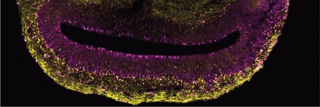 Human-specific gene involves in neocortical expansion during evolution
