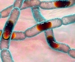 Novel therapeutic treats B. anthracis infection without antibiotics
